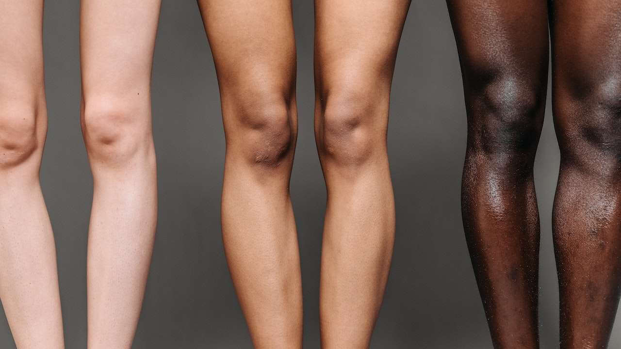 Closeup of 3 women’s legs with light, medium, and dark skin color, all demonstrating dark areas of skin on the knees.