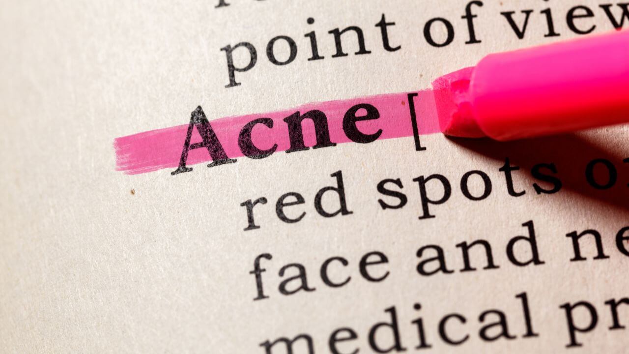 The word Acne being highlighted with a pink highlighter in the dictionary.