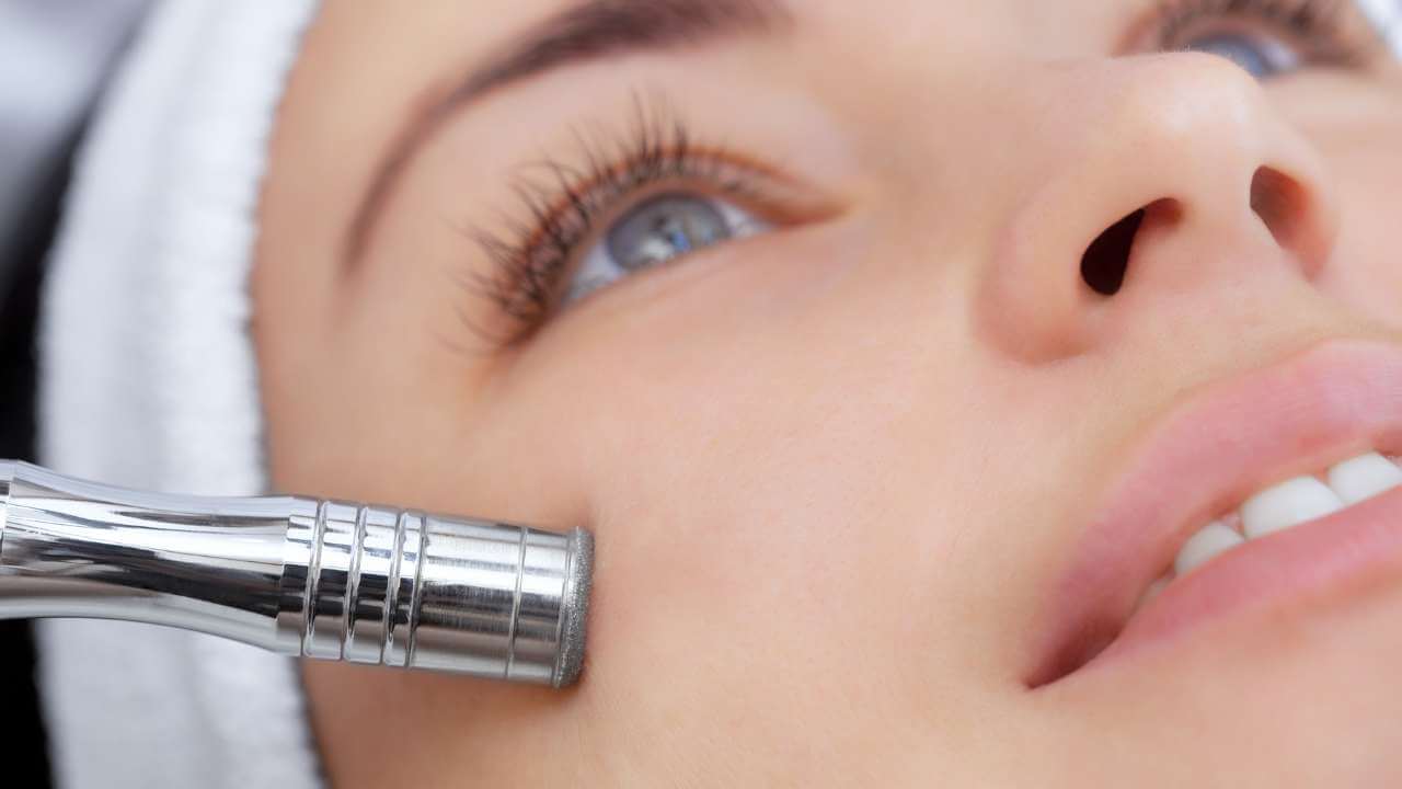 Closeup view of woman’s face as she receives microdermabrasion to her right cheek for acne related hyperpigmentation.