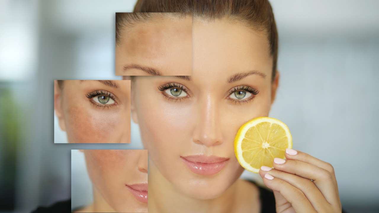 Woman holding an orange slice with dark spots on her face before using skincare products and normal skin texture after.