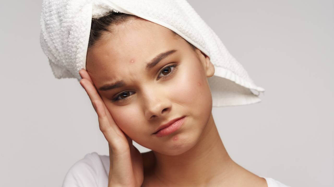 Woman tilting her head with hair wrapped in a towel is sad about 3 small red bumps caused by acne vulgaris on her face.