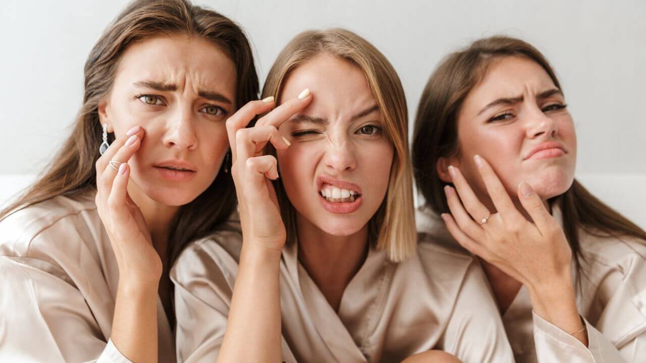 A close up of 3 young, unhappy women wearing robes, touching their problem areas on their cheeks and forehead.